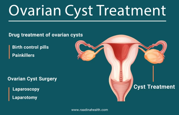 CAN OVARIAN CYSTS CONTRIBUTE TO INFERTILITY?: Rocky Mountain