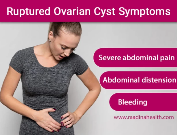Ruptured Ovarian Cyst: What Happens When a Cyst Bursts? - Raadina