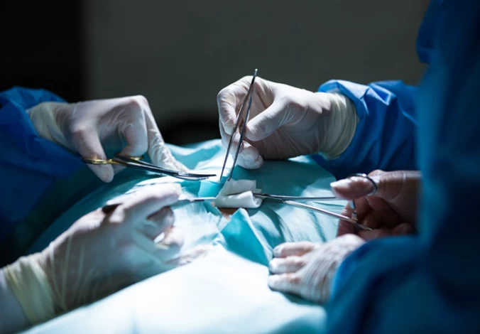 Micro-TESE Surgery Micro-TESE Surgery