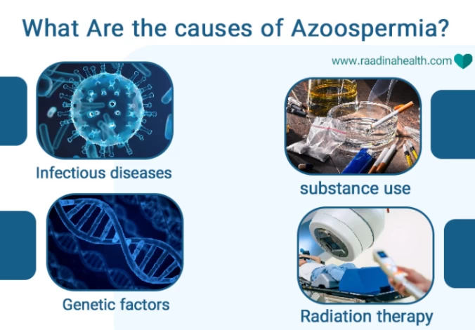 What Are the causes of Azoospermia? What Are the causes of Azoospermia?