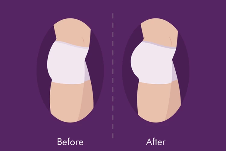 The Pros and Cons of Butt Implants: What You Need to Know