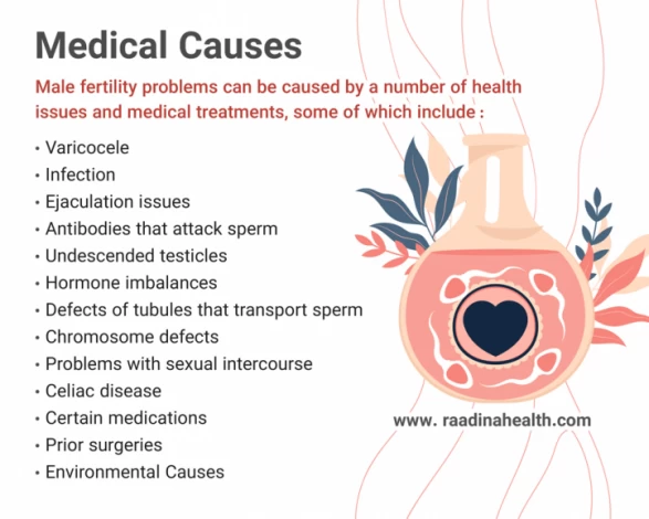 Grade 3 Varicocele Symtoms & Treatments - Raadina Health