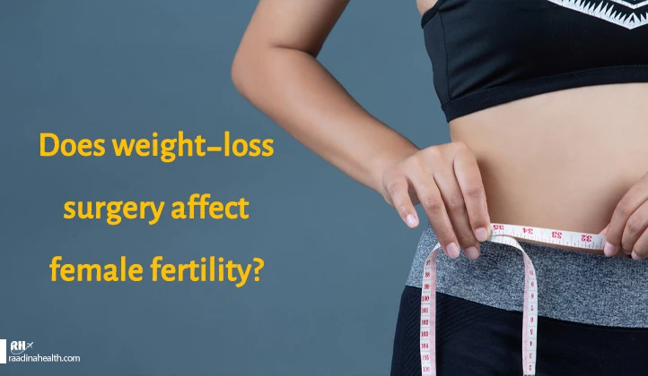 Does weight-loss surgery affect female fertility?