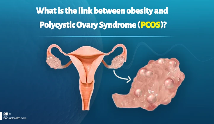 The link between obesity and Polycystic Ovary Syndrome (PCOS)