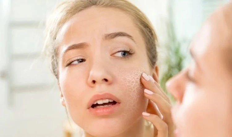 راهکار هایی برای جلوگیری از خشک شدن پوست