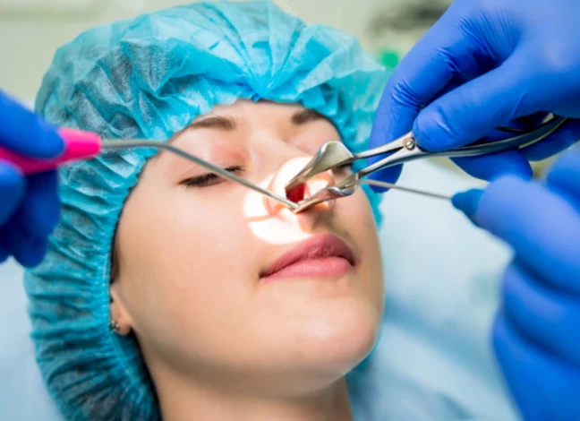 Alternatives to Septoplasty Surgery Alternatives to Septoplasty Surgery