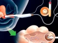 what to avoid after egg retrieval?