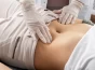 pregnancy after tummy tuck