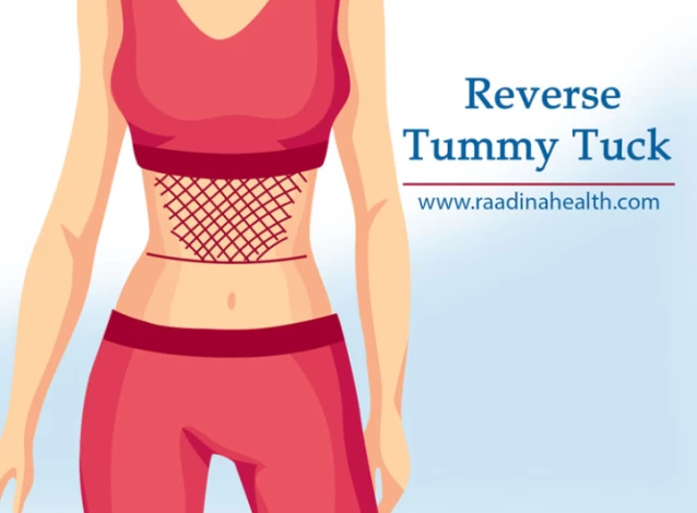 Reverse Tummy Tuck 