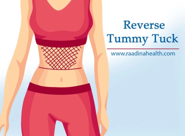 ✨WHAT IS IT?: Reverse Tummy Tuck✨ A reverse abdominoplasty (reverse tummy  tuck) is chosen for the individual who has loose excess skin in the  upper