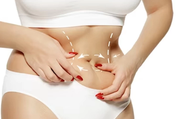 The mini tummy tuck is a procedure to remove excess skin and fat in the lower abdomen.