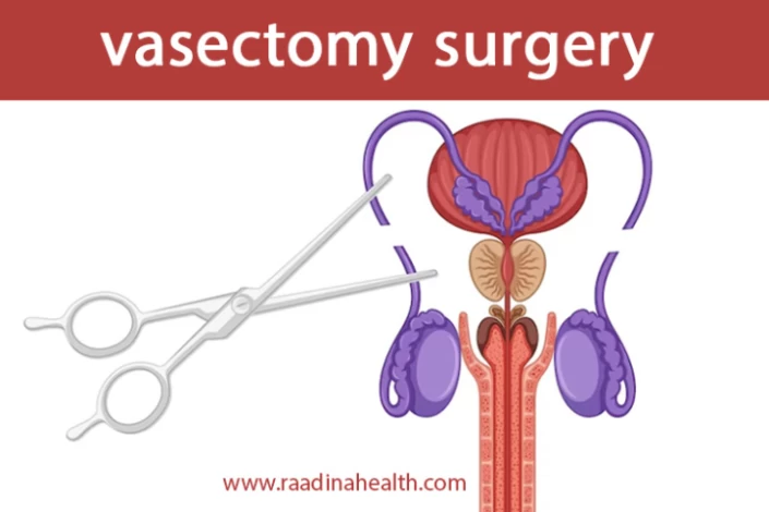 How Vasectomy Surgery Is Done? + [Recovery & Side effects