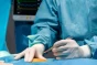 Vasectomy Surgery