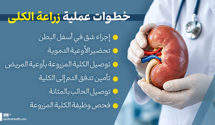 خطوات عملية زراعة الكلى