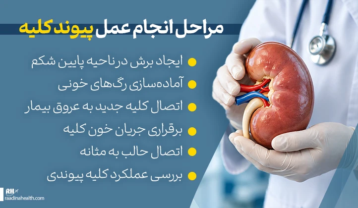 مراحل انجام عمل پیوند کلیه