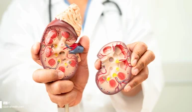 پیوند کلیه چیست؟ راهنمای کامل از تشخیص تا مراقبت بعد از عمل