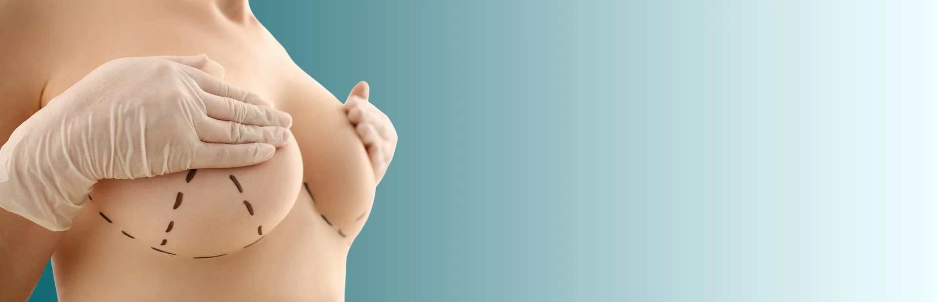 Breast Reduction in Iran Breast Reduction in Iran