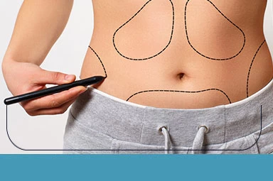 Abdominoplasty Abdominoplasty